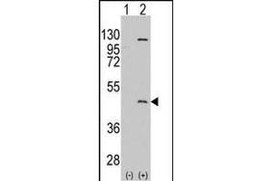 Western blot analysis of PRMT8 (arrow) using rabbit polyclonal PRMT8 Antibody (C-term) (ABIN388025 and ABIN2845473). (PRMT8 Antikörper  (C-Term))