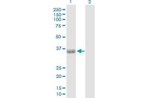 Western Blot analysis of PHF11 expression in transfected 293T cell line by PHF11 MaxPab polyclonal antibody. (PHF11 Antikörper  (AA 1-292))