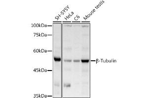 Western blot analysis of extracts of various cell lines, using β-Tubulin antibody (ABIN3020552, ABIN3020553 and ABIN3020554) at 1:1000 dilution. (TUBB Antikörper  (AA 40-260))