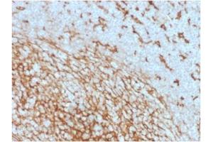 ABIN6383875 to CD14 was successfully used to stain membranes of macrophages in human lymph node and tonsil sections. (CD14 Antikörper  (Extracellular Domain))