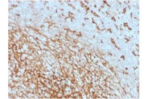 Immunohistochemistry (IHC) image for anti-CD14 (CD14) (AA 25-148), (Extracellular Domain) antibody (ABIN6383875)