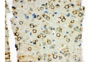 Anti-XRCC3 antibody, IHC(P) IHC(P): Rat Brain Tissue (XRCC3 Antikörper  (C-Term))