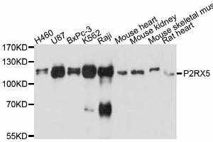 Western blot analysis of extracts of various cell lines, using P2RX5 antibody.
