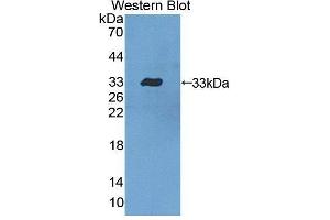 Western blot analysis of the recombinant protein. (Dystrobrevin beta Antikörper  (AA 1-249))