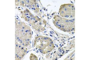 Immunohistochemistry of paraffin-embedded human stomach using NDUFA6 antibody. (NDUFA6 Antikörper  (AA 35-154))