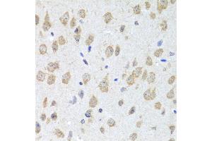 Immunohistochemistry of paraffin-embedded mouse brain using CXCL8 antibody (ABIN6290535) at dilution of 1:100 (40x lens). (IL-8 Antikörper)