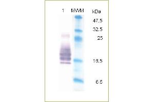SDS-PAGE analysis of recombinant GM-CSF.