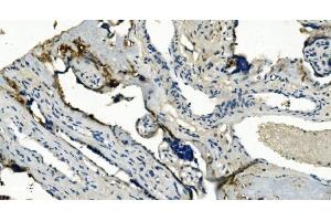 IHC analysis of TMBIM1 using anti-TMBIM1 antibody (ABIN7603190).