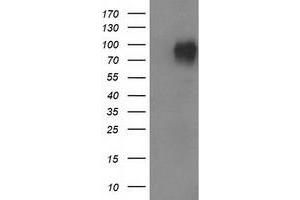 HEK293T cells were transfected with the pCMV6-ENTRY control (Left lane) or pCMV6-ENTRY VCAM1 (Right lane) cDNA for 48 hrs and lysed. (VCAM1 Antikörper)