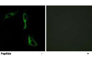 Immunofluorescence analysis of HeLa cells, using ADRA1D polyclonal antibody . (ADRA1D Antikörper)