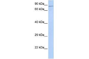 WB Suggested Anti-ZNF226 Antibody Titration:  0. (ZNF226 Antikörper  (Middle Region))