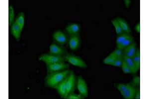 Immunofluorescent analysis of Hela cells using ABIN7145827 at dilution of 1:100 and Alexa Fluor 488-congugated AffiniPure Goat Anti-Rabbit IgG(H+L) (TNFAIP1 Antikörper  (AA 233-316))
