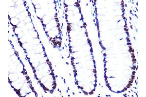 Immunohistochemistry of paraffin-embedded human colon using L Rabbit mAb (ABIN7270266) at dilution of 1:100 (40x lens). (ASH2L Antikörper)