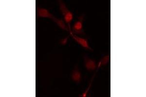 ABIN6274474 staining HepG2 cells by IF/ICC. (MASTL Antikörper  (C-Term))