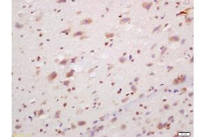 Formalin-fixed and paraffin embedded rat brain labeled with Anti-PCP4/PEP-19 Polyclonal Antibody, Unconjugated (ABIN1385742) at 1:200, followed by conjugation to the secondary antibody and DAB staining (PCP4 Antikörper  (AA 21-62))