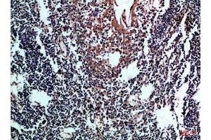 Immunohistochemical analysis of paraffin-embedded Human-tonsil, antibody was diluted at 1:100 (CD8 Antikörper  (AA 100-160))