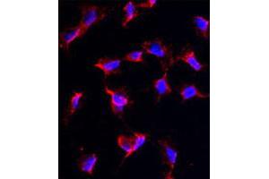Immunofluorescence analysis of NANOS1 polyclonal antibody  in HeLa cells. (Nanos Homolog 1 Antikörper  (C-Term))