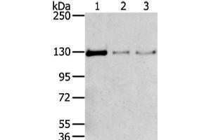 Western Blot analysis of 293T, 231 and lo2 cell using TRIM24 Polyclonal Antibody at dilution of 1/400
