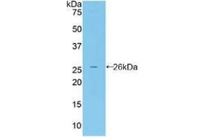Western blot analysis of recombinant Mouse FBLN2. (FBLN2 Antikörper  (AA 896-1106))