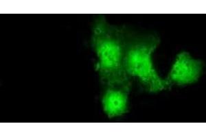 Anti-GBE1 mouse monoclonal antibody (ABIN2453066) immunofluorescent staining of COS7 cells transiently transfected by pCMV6-ENTRY GBE1 (RC204152). (GBE1 Antikörper)