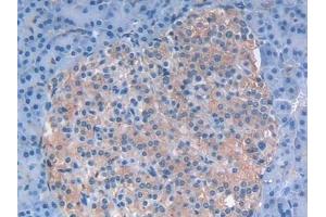 Immunohistochemistry (IHC) image for anti-Leukemia Inhibitory Factor (LIF) (AA 2-201) antibody (ABIN7430882)