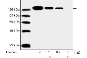 Western blot analysis of PEGylated drug (Pegasys, Peginterferon Alfa 2A) and Non-PEGylated Interferon Alfa 2A protein using the PEG Antibody [Biotin], mAb, Mouse (0. (PEG Antikörper  (Biotin))