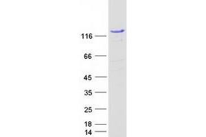 Validation with Western Blot (STAT2 Protein (Myc-DYKDDDDK Tag))