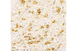 Immunohistochemistry (Paraffin-embedded Sections) (IHC (p)) image for anti-Adhesion Molecule with Ig-Like Domain 2 (AMIGO2) antibody (ABIN7072966)