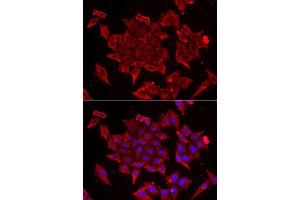 Immunofluorescence analysis of U2OS cell using TIMM17A antibody. (TIMM17A Antikörper)