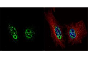 ICC/IF Image PRP19 antibody [C1C3] detects PRP19 protein at nucleus by immunofluorescent analysis. (PRP19 Antikörper)