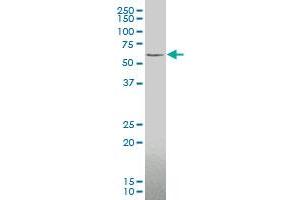 ZIC3 monoclonal antibody (M05), clone 2C1 Western Blot analysis of ZIC3 expression in Y-79 . (ZIC3 Antikörper  (AA 182-274))