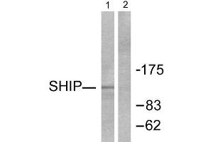 Western Blotting (WB) image for anti-Inositol Polyphosphate-5-Phosphatase, 145kDa (INPP5D) (C-Term) antibody (ABIN1848768) (INPP5D Antikörper  (C-Term))