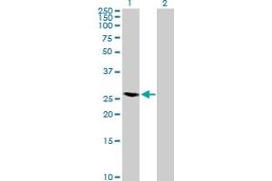 Western Blot analysis of RAB40A expression in transfected 293T cell line by RAB40A MaxPab polyclonal antibody. (RAB40A Antikörper  (AA 1-277))