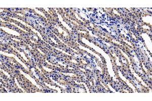 Detection of IL11Ra in Rat Kidney Tissue using Polyclonal Antibody to Interleukin 11 Receptor Alpha (IL11Ra) (IL11RA Antikörper  (AA 24-371))