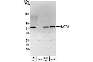 Western Blotting (WB) image for anti-GATA Binding Protein 4 (GATA4) (AA 392-442) antibody (ABIN7453878)