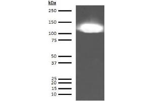 Western Blotting (WB) image for anti-KININOGEN HMW antibody (ABIN613715) (KININOGEN HMW Antikörper)