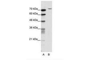 Image no. 1 for anti-TAF6 RNA Polymerase II, TATA Box Binding Protein (TBP)-Associated Factor, 80kDa (TAF6) (N-Term) antibody (ABIN202866) (TAF6 Antikörper  (N-Term))