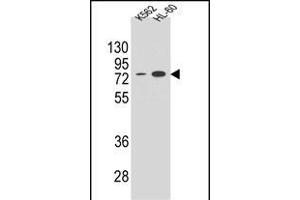 ENTPD3 Antibody (C-term) (ABIN654673 and ABIN2844368) western blot analysis in K562 and HL-60 cell line lysates (35 μg/lane). (ENTPD3 Antikörper  (C-Term))