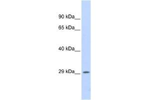 WB Suggested Anti-PSME1 Antibody Titration: 0. (PSME1 Antikörper  (Middle Region))