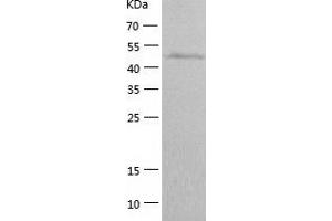 Western Blotting (WB) image for Myeloproliferative Leukemia Virus Oncogene (MPL) (AA 26-491) protein (His tag) (ABIN7124044)