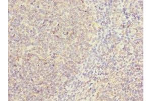 Immunohistochemistry of paraffin-embedded human tonsil tissue using ABIN7146507 at dilution of 1:100 (CAMSAP2 Antikörper  (AA 1-150))