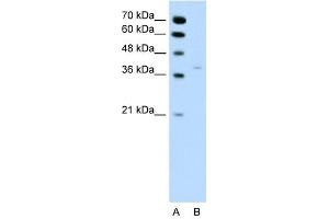 HSD17B1 antibody used at 0. (HSD17B1 Antikörper)