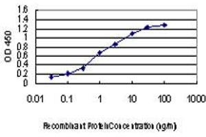 Detection limit for recombinant GST tagged IRAK2 is approximately 0. (IRAK2 Antikörper  (AA 111-210))