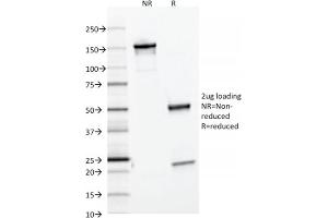 SDS-PAGE Analysis Purified Ferritin, Light Chain Mouse Monoclonal Antibody (FTL/1386). (FTL Antikörper  (AA 38-165))