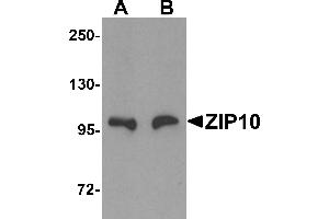 Western Blotting (WB) image for anti-Solute Carrier Family 39 (Zinc Transporter), Member 10 (SLC39A10) (Middle Region) antibody (ABIN1031176) (SLC39A10 Antikörper  (Middle Region))