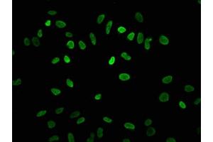 Immunofluorescence staining of Hela cells with ABIN7139182 at 1:7. (HIST1H3A Antikörper  (acLys4))