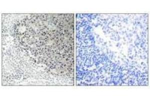 Immunohistochemistry analysis of paraffin-embedded human tonsil tissue using Collagen IX α3 antibody.