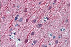 Human Brain, Cortex: Formalin-Fixed, Paraffin-Embedded (FFPE) (TUBB2A Antikörper  (AA 1-446))