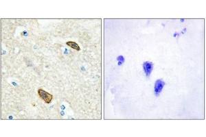 Immunohistochemical analysis of paraffin-embedded human brain tissue using PLXDC1 antibody. (PLXDC1 Antikörper  (Internal Region))