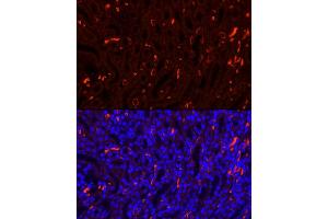 Immunofluorescence analysis of Mouse kidney using SLC4 antibody (7391 ) at dilution of 1:100. (Band 3/AE1 Antikörper  (AA 1-353))